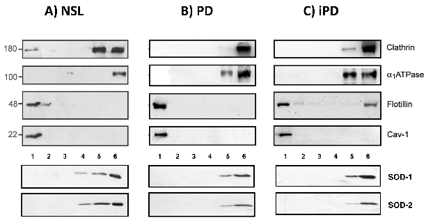 Western blot analyses of protein markers across density gradient fractions from control, Parkinson's disease, and incidental PD brain cortices reveal altered lipid raft protein distribution.