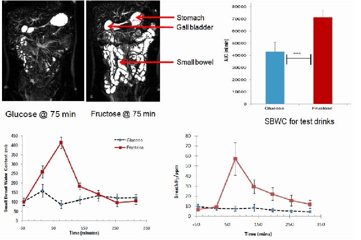 Figure 2. Small bowel water content (SBWC) and breath hydrogen (H2) concentrations after drinking each of the drinks: glucose and fructose. The time of drinking (t = 0 min) is highlighted in the chart. Values of SBWC are mean volume (mL) ˘ s.e.m (standard