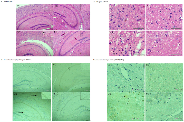 Immunofluorescence staining of amyloid-beta plaques in the temporal cortex and hippocampus shows reduced plaque burden in nutrient-treated APP-PSN transgenic mice.