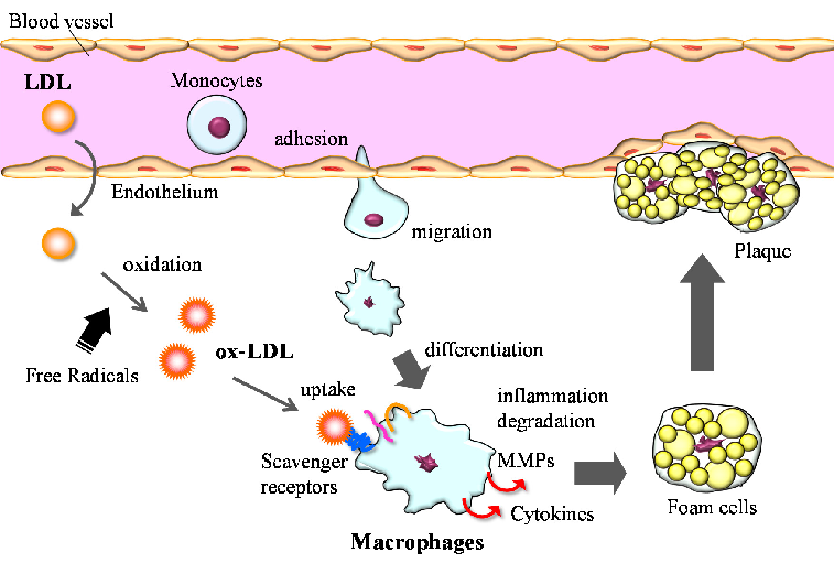 Macrophages play a central role in atherosclerosis development through uptake of oxidized LDL, foam cell formation, and secretion of inflammatory mediators. Astaxanthin may interrupt this process by reducing LDL oxidation and modulating macrophage activity.