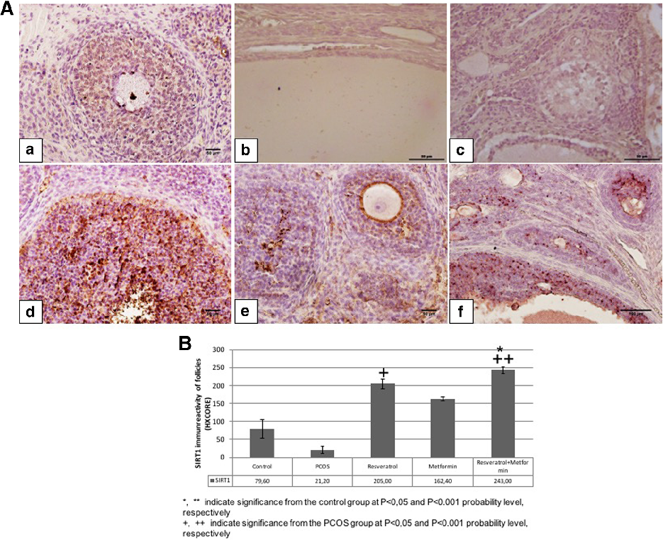 Fig. 2 A Representative SIRT1 immunreactivity in control, PCOS, resveratrol, metformin and metformin+resveratrol groups. a; control, b; PCOS, c; solvent, d; resveratrol, e; metformin and f; metformin+resveratrol groups. B HSCORE of SIRT1 immunostaining in