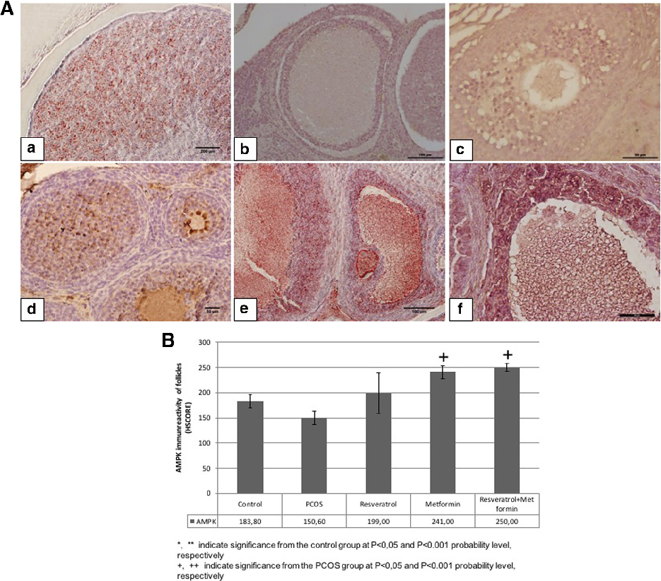 Fig. 3 A Representative AMPK immunreactivity in control, PCOS, resveratrol, metformin and metformin+resveratrol groups. a; control, b; PCOS, c; solvent, d; resveratrol, e; metformin and f; metformin+resveratrol groups. B HSCORE of AMPK immunostaining in c