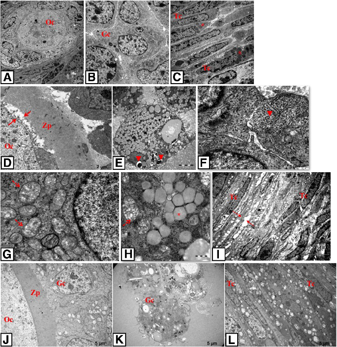 Fig. 5 TEM photomicrographs of control and PCOS groups. Oocyte, granulosa and theca cells of follicles in control group (a-c), in PCOS group (d-i) and in solvent group (j-l). D shows the relation between oocyte-zona pellucida-granulosa cells; e-h show gra