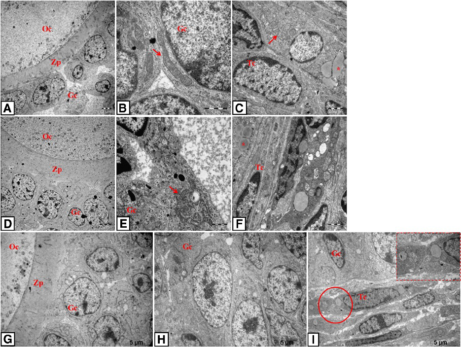 Fig. 6 TEM photomicrographs of resveratrol, metformin and metformin+resveratrol-treated rats. Oocyte, granulosa and theca cells of follicles in resveratrol group (a-c), in metformin group (d-f) and in metformin+resveratrol group (g-i). Arrows indicate hea