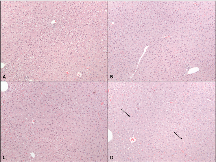 Figure 3. Eﬀects of 2-week administration of CBD on liver histomorphology. H&amp;E stained liver sections from (A) vehicle mice or those gavaged with (B) 61.5 mg/kg, (C) 184.5 mg/kg, or (D) 615 mg/kg CBD in sesame oil for 2 weeks. Note that 615 mg/kg grou