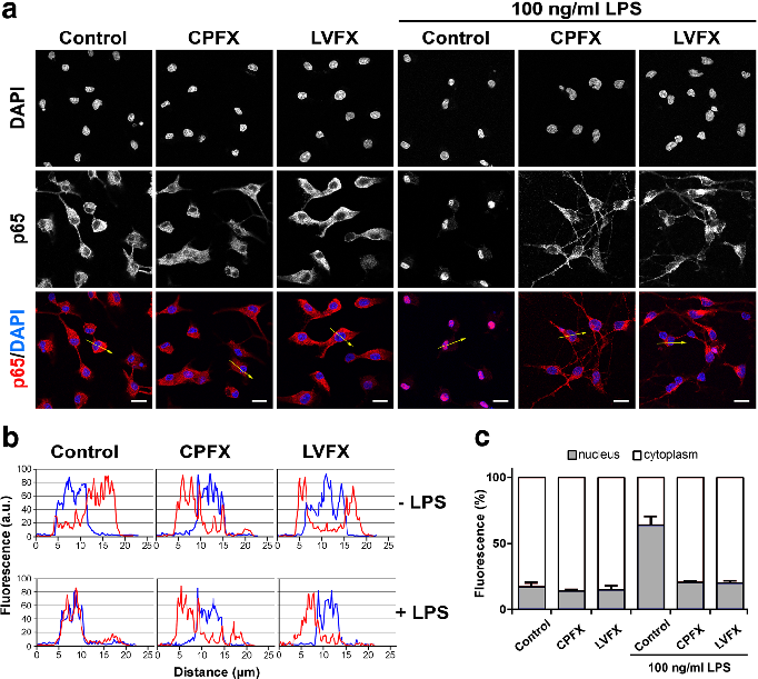NF-kB nuclear translocation in LPS-stimulated microglia is attenuated by both ciprofloxacin and levofloxacin, as shown by immunofluorescence or reporter gene assays.