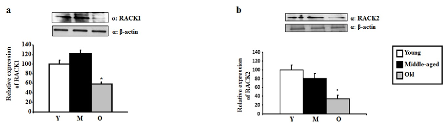 Activated PKC translocation to membrane fractions is diminished in aged rats, with reduced binding to RACK scaffolding proteins contributing to impaired neuroprotective signaling.