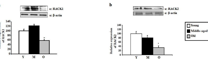 Quantitative densitometry of PKC isoform bands confirms statistically significant declines in neuroprotective PKC levels with advancing age.