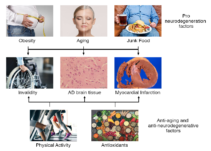 Figure 1 Prodegeneration factors including ageing, obesity and unhealthy diets could be balanced by physical activity, caloric restriction, and anti-oxidants to mitigate the onset, severity and duration of neurodegenerative diseases. AD: Alzheimer’s disea