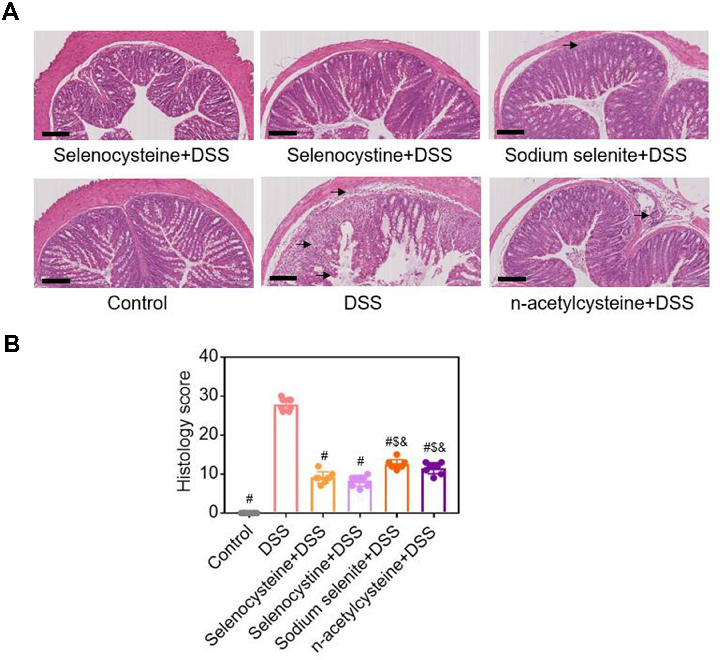 Figure 3 Histological examinations of effects of selenium-containing amino acids on DSS-induced IBD in mice. (A) Representative H&amp;E-stained colon sections of each group (scale bar, 200 μm); (B) Histological scoring of mice treated with selenium-contai