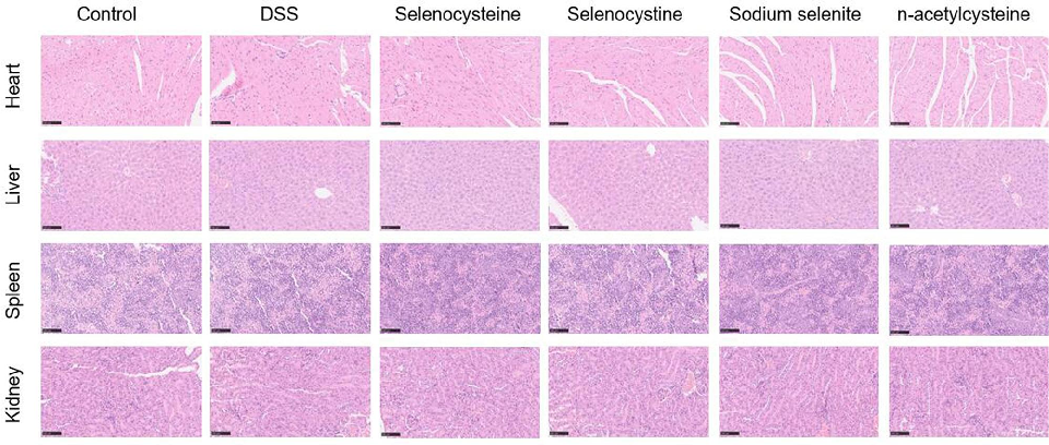 Figure 7 Histological examination of the safety of selenium-containing amino acids. Lung, kidney, heart, liver, and spleen tissues were collected, H&amp;E stained, and analyzed for the safety profile of selenium-containing amino acids. Scale bar is 100 μm