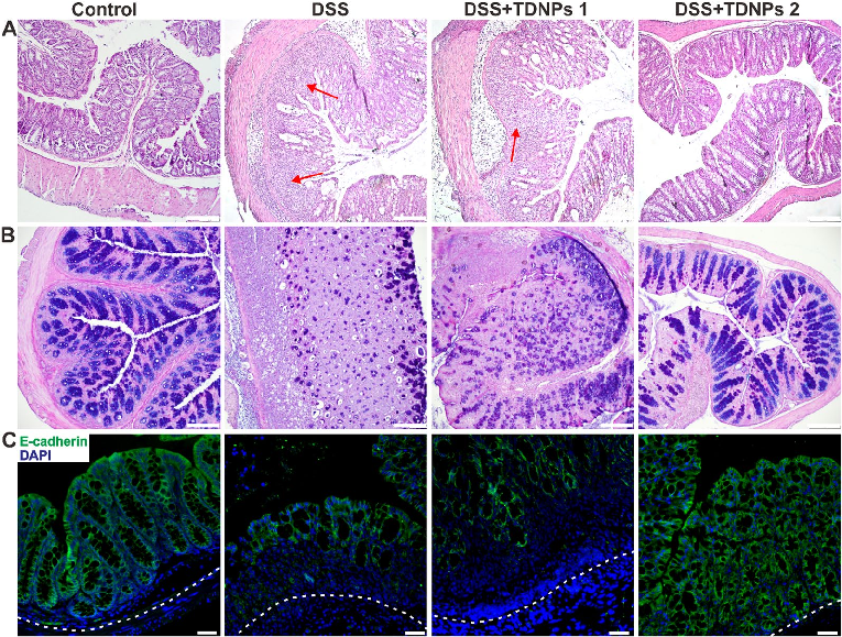 Fig. 7 Histological stain to evaluate the protective effect of TDNPs 2 on colitis. A Representative H&amp;E-stained colon. Inflammatory cell infiltration was indicated by arrowheads. B Colonic goblet cells were stained by Alcian blue. As goblet cells prod
