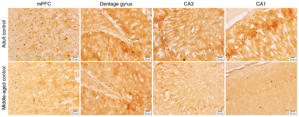 Figure 1. Expression of c‑Fos was evaluated by immunohistochemical staining. Middle‑aged control rats showed lower c‑Fos expression than the adult controls in the mPFC, dentate gyrus, CA3, and CA1 areas. Magnification, x20; scale bar, 50 µm. mPFC, medial 
