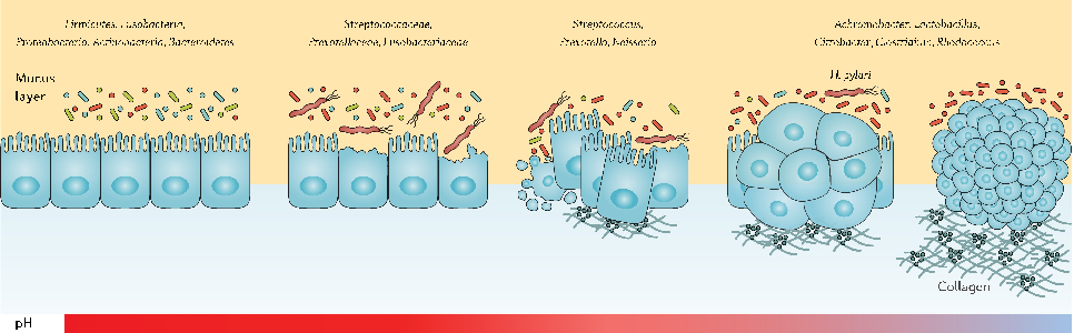 The dual nature of probiotic effects on established gut communities is depicted, with some participants showing enhanced diversity while others experience transient dysbiosis.