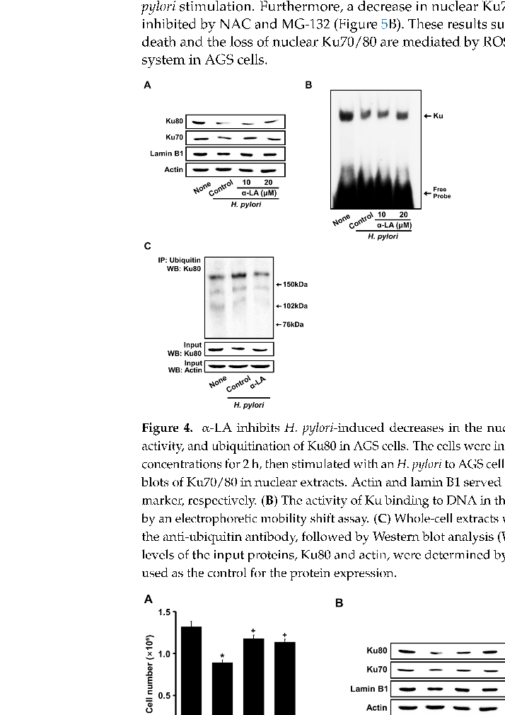 Cell viability analysis across different alpha-lipoic acid concentrations in H. pylori-infected gastric epithelial cells, establishing the effective dose range for cytoprotection.