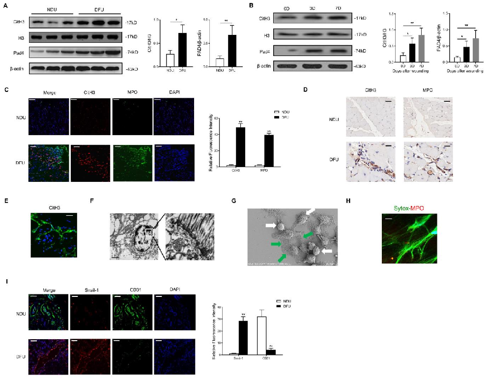 Compared with NDU wounds, the Hippo-YAP pathway in DFU wounds was found to be significantly inhibited (Fig. 2A). Then we explored the detailed molecular mechanism of this phenomenon. The DNA scaffold of NETs can be hydrolyzed by
