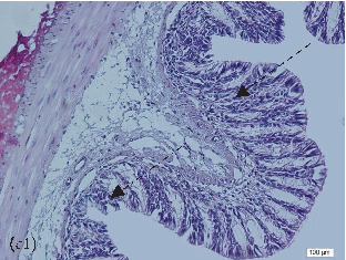 Summary of controversial findings regarding NAC's differential effects across organs, with protective trends observed in some tissues but potential adverse signals in others.