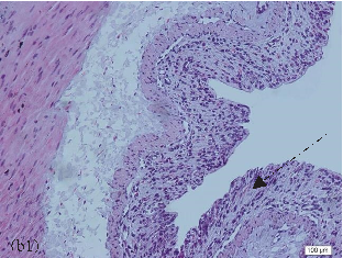 Colon length measurements and macroscopic damage scoring in the colitis model, providing gross anatomical evidence of disease severity and NAC treatment response.