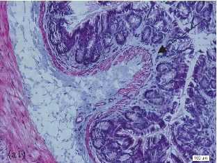 Inflammatory cytokine levels (such as TNF-alpha, IL-6, or IL-1beta) in colonic and extraintestinal tissues, assessing whether NAC modulates systemic inflammation originating from the gut.