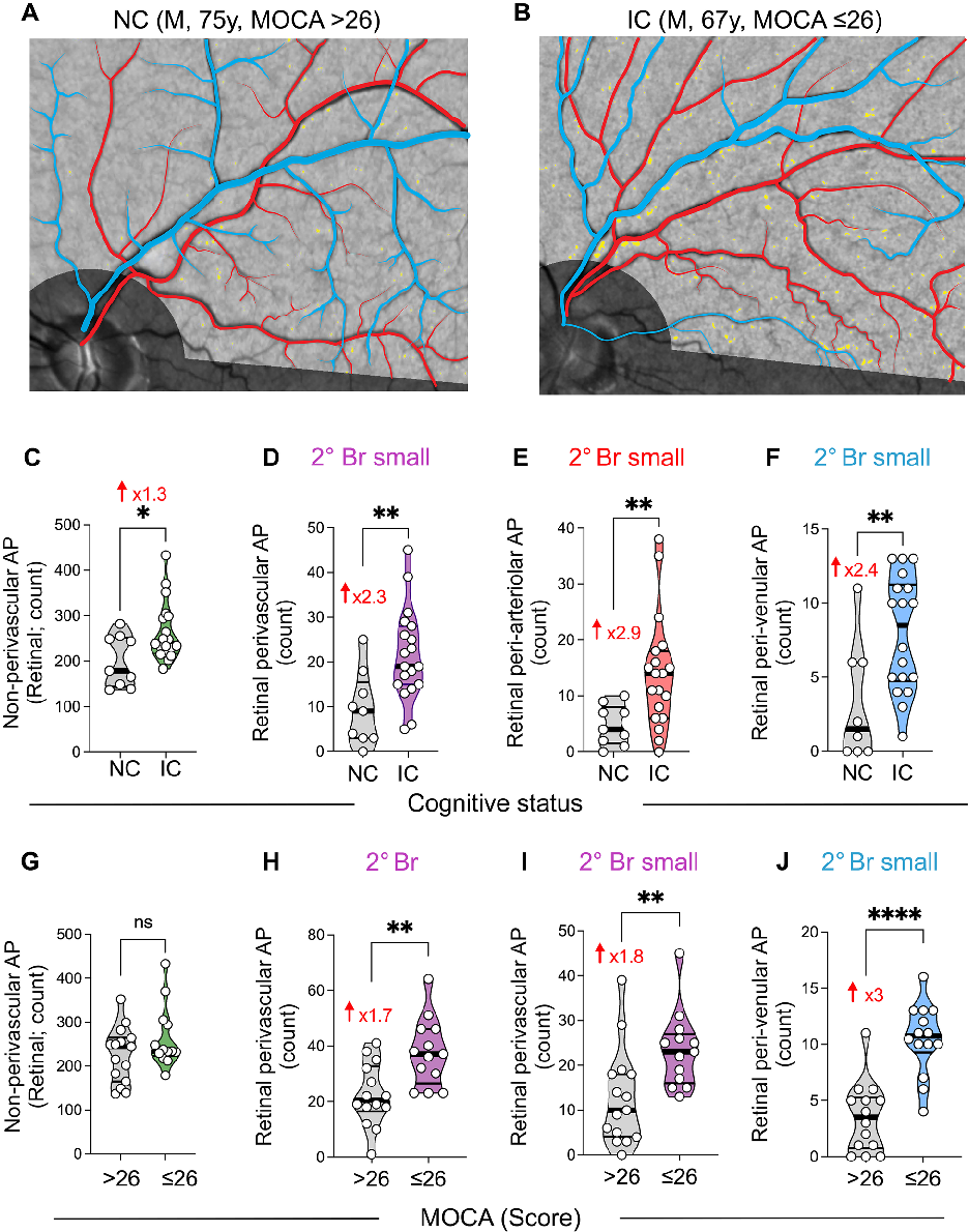 Graphical representation of outcomes in a study of retinal peri, highlighting trends observed across experimental conditions.