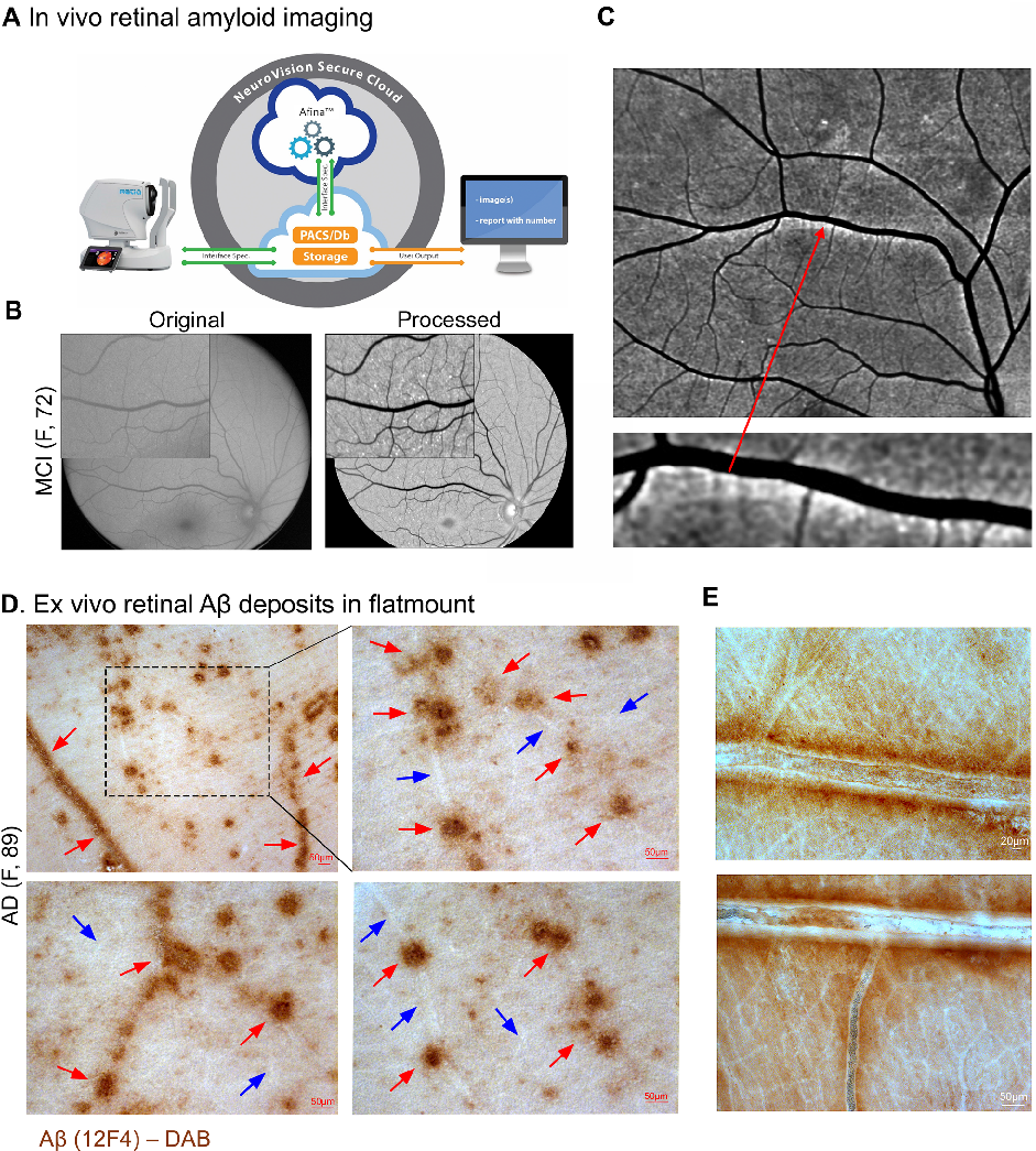Statistical analysis from research investigating retinal peri, comparing treatment groups and control conditions.