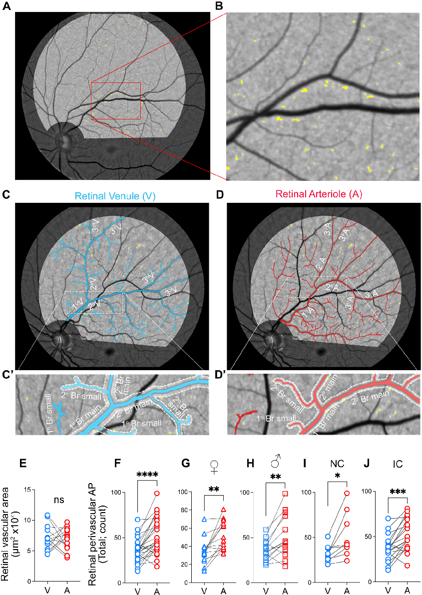 Measured parameters from a study evaluating retinal peri, contributing to the overall assessment of the relationship between amyloidosis and vasculature in cognitive impairment and Alzheimer's disease (AD) pathogenesi.