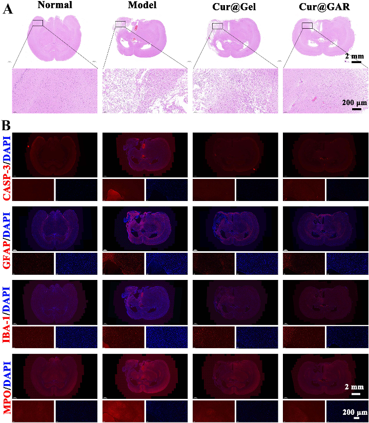 Figure 5 (A) H&amp;E staining images of brain tissue sections from experimental rats on day 7 after surgery. (B) Immunofluorescence staining images of CASP-3, GFAP, IBA-1, and MPO in brain tissue sections of experimental rats on day 7 after surgery.